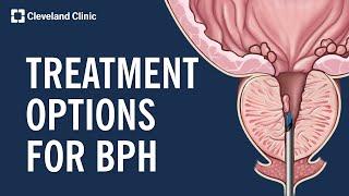 Treating Benign Prostatic Hyperplasia BPH