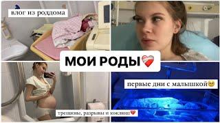 МОИ РОДЫ️‍🩹 Я РОДИЛА ИСТОРИЯ МОИХ РОДОВ И ПЕРВЫЕ ДНИ С МАЛЫШКОЙ ПЦ КОНЧАЛОВСКОГО