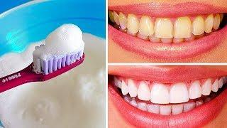 10 formas naturales de blanquear los dientes amarillentos en casa
