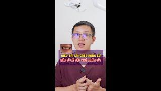 Điều trị lại case răng sứ bác sĩ gặp khó khăn gì?