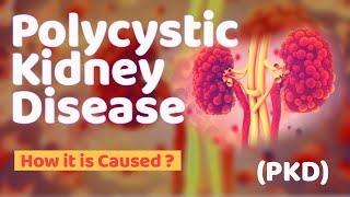 How Polycystic kidney disease PKD is Caused  Genes of PKD  Genetic disorders @BiotechReview