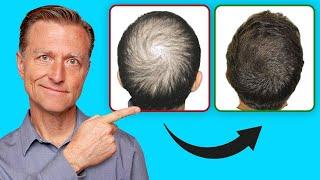 Saçınızı Yeniden Nasıl Çıkarabilirsiniz GÜNCEL ÖNEMLİ BİLGİLER  Dr.Berg Türkçe