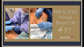 Non-Surgical Breast Lift With PRP & PDO Threads