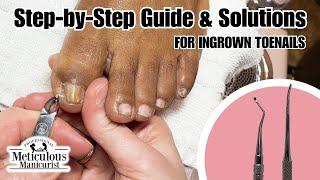 Tips For Instant Big Toe Pain Relief at Home #nails #satisfying