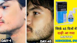 Day -1 to day-45 beard growth journey  mintop minoxidil 5 beard  minoxidil beard growth  beard