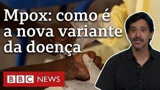 Mpox quais as características da nova variante que fez OMS decretar emergência de saúde