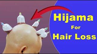 Does Hijama Therapy useful in Hair Loss  What is Hijama Therapy  बाल झड़ने में हिजामा थेरेपी