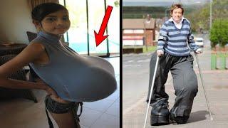 Bizarre People With Extraordinary Body Parts