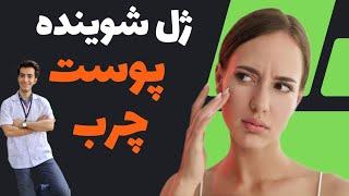 ژل شوینده پوست چرب  کاهش چربی پوست  رفع جای جوش  بستن منافذ باز پوست  Reduce skin oil