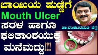 How to treat mouth ulcers at home  Easy Home Remedies For Mouth Ulcers  Get Rid of a Canker Sore?