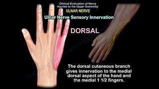 ULNAR NERVE INJURY CAUSES SYMPTOMS DIAGNOSIS  AND TREATMENT. Cubital tunnel syndrome.