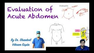 Evaluation of Acute abdomen