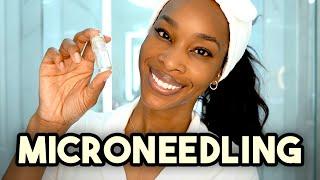 Microneedling What you need to know from a dermatologist and Skin of color Expert