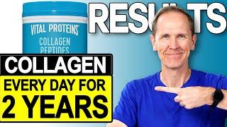 Vital Proteins Collagen Peptides  Results After 2 Years