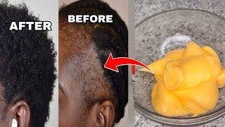 THIS HAIR GROWTH TREATMENT IS BREAKING THE INTERNET HOW TO GROW YA HAIR FASTER HAS BEEN DISCOVERED