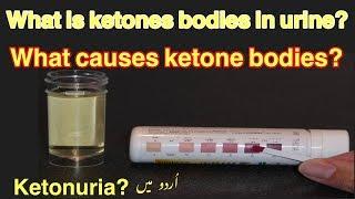 What is Ketone bodies?  What causes ketone bodies in urine?  Ketonuria? urdu hindi