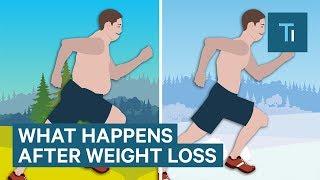 What Losing Weight Does To Your Body And Brain  The Human Body