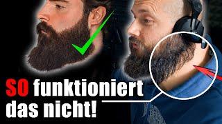 Langer BART trotz massiver Schwachstelle?  Bartwuchs Info Check