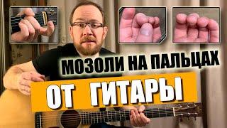 Сухие мозоли на пальцах от струн при игре на гитаре. Что делать и как убрать?