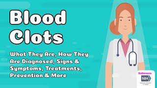 Blood Clots - What They Are How They Are Diagnosed Signs & Symptoms Treatments Prevention & More