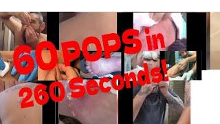 60 Pops in 260 seconds Cyst Zip Pimple Abscess pops and more Plus a chance to win merch