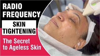 Radio Frequency Skin Tightening - The Secret to Ageless Skin  Sakhiya Skin Clinic