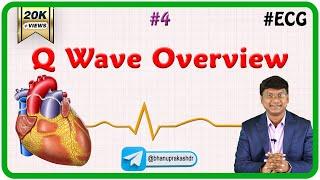 4. Q Wave Overview - ECG assessment and ECG interpretation made easy