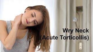 Wry Neck Acute Torticollis