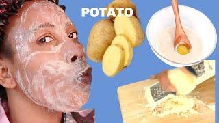 I USE POTATO TO WASH MY FACE CLEAR BRIGHTER SMOOTH SKIN CLEAR HYPERPIGMENTATION REDUCE WRINKLES