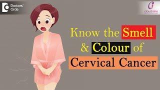 Smell and Colour of Cervical Cancer  Check for these Important Signs  - Dr. Sapna Lulla of C9