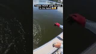 Monster Fish + treble hook gets BURIED in his HAND #floridafishing