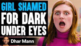 GIRL SHAMED For DARK UNDER EYES Ft. Christen Dominique  Dhar Mann