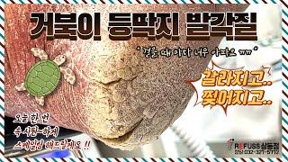 거북이 등딱지처럼 딱딱한‼️ 과각화 무좀발각질 관리  Hyperkeratosis Athletes Foot Keratin Management