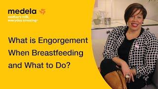 What to do if your breasts are engorged