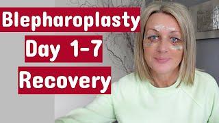 My Eye Surgery Upper&Lower blepharoplasty  Day 1-7 Recovery