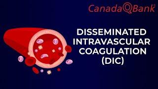 DIC Disseminated intravascular coagulation