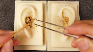 ASMR Ear Cleaning No Talking