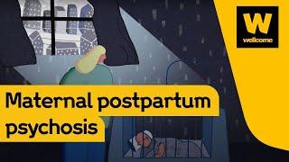 Postpartum psychosis a mother’s story  Wellcome