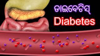 Diabetes in Odia Causes Symptoms & Treatment  diabetes odia  symptoms of diabetes