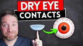 Best Contact Lenses For Dry Eyes 2023