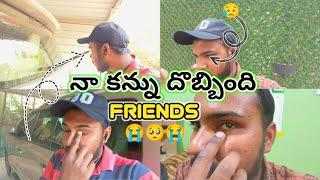 నా కన్ను దొబ్బింది Friends  ll Friends caught my ️ ll 