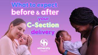 What to expect during & after a c-section delivery