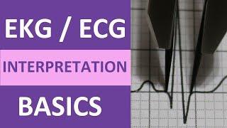 EKGECG Interpretation Basics Nursing NCLEX  QRS Complex P Wave T Wave PR Interval