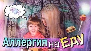 Аллергия на Еду что Ест Эсми? Адисовна ДЕТИ