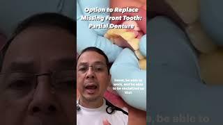 Option to Replace Missing Front Tooth Partial Denture  View Mobile Dental