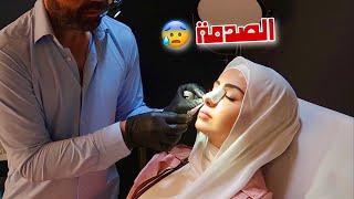 نتيجة عملية تجميل أنفي بكيت