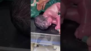 proses penyelamatan bayi yang baru lahir
