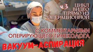 Вакуум-аспирация. Цикл видео из операционной ч.3. Ника Спринг.