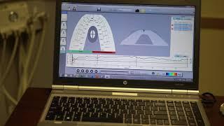 T SCAN OCCLUSAL ANALYSIS