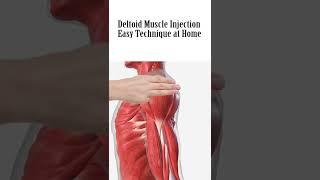 How to give an intramuscular IM Injection in deltoid muscle in shoulder easily at home